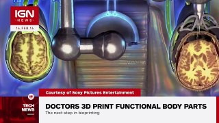 Doctors 3D Print Functional Body Parts IGN News