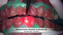 DENTI SUBITO BIANCHI sbiancamento istantaneo incredibile ma VERO