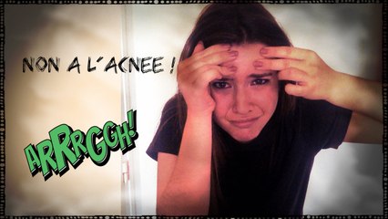 Tutoriel pour faire disparaître un bouton d'acné !