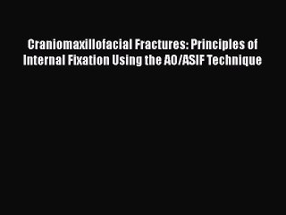 Download Craniomaxillofacial Fractures: Principles of Internal Fixation Using the AO/ASIF Technique