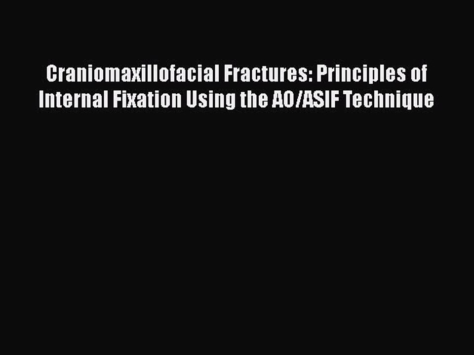 Download Craniomaxillofacial Fractures: Principles of Internal Fixation Using the AO/ASIF Technique