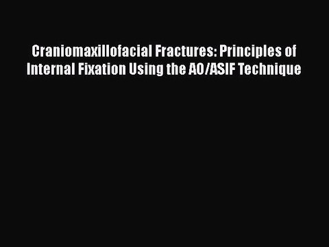 Download Craniomaxillofacial Fractures: Principles of Internal Fixation Using the AO/ASIF Technique