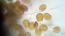 Dinoflagellates Amphidinium 400x