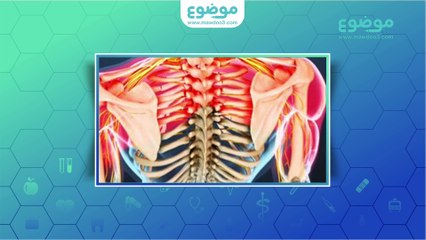 أعراض الانزلاق الغضروفي العنقي