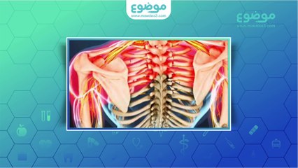 العلاج الجراحي للانزلاق الغضروفي العنقي