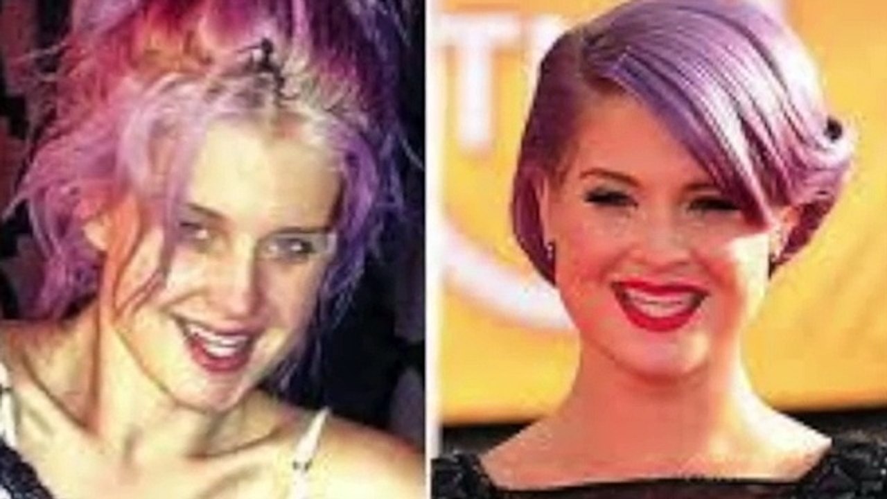 Celebs With No Makeup