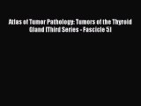 Read Atlas of Tumor Pathology: Tumors of the Thyroid Gland [Third Series - Fascicle 5] PDF