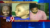 Cruel parents brutally torture small baby in Medak