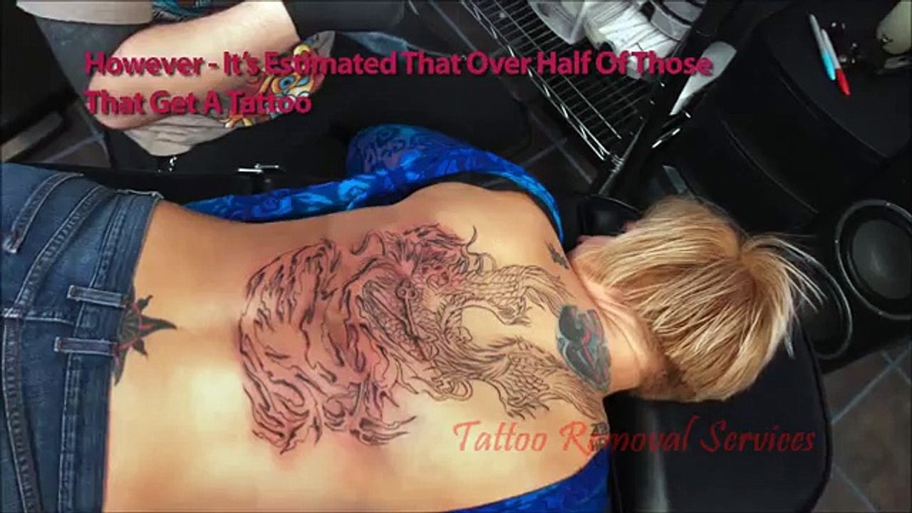 Tattoo Removal Richmond VA