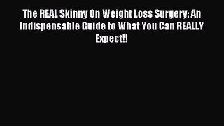 Read The REAL Skinny On Weight Loss Surgery: An Indispensable Guide to What You Can REALLY