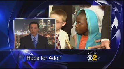 SoCal Couple Hosts Ugandan Boy As He Waits For Reconstructive Surgeries-SD