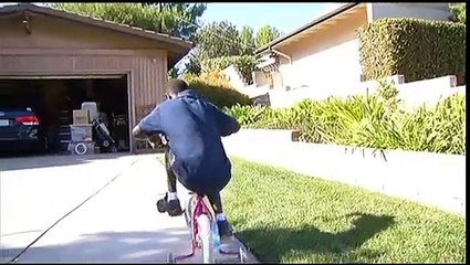 Ugandan Boy Badly Burned Being Helped by Southern Californians-SD