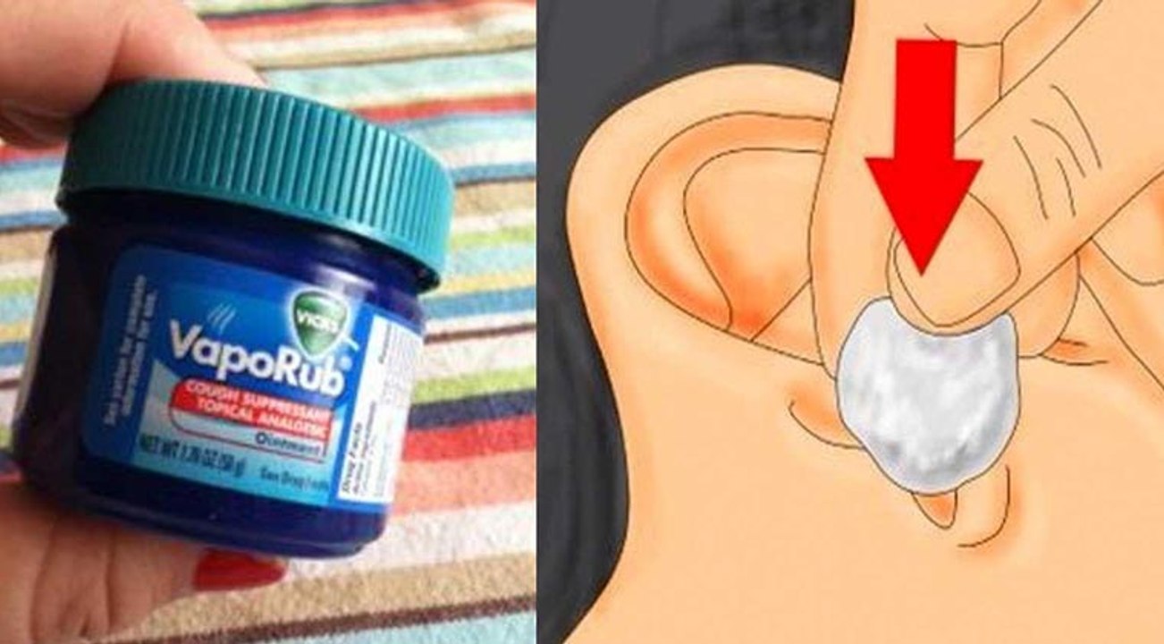 Ele colocou Vicks Vaporub no ouvido... O resultado... UAU! Quem me dera saber disto mais cedo!