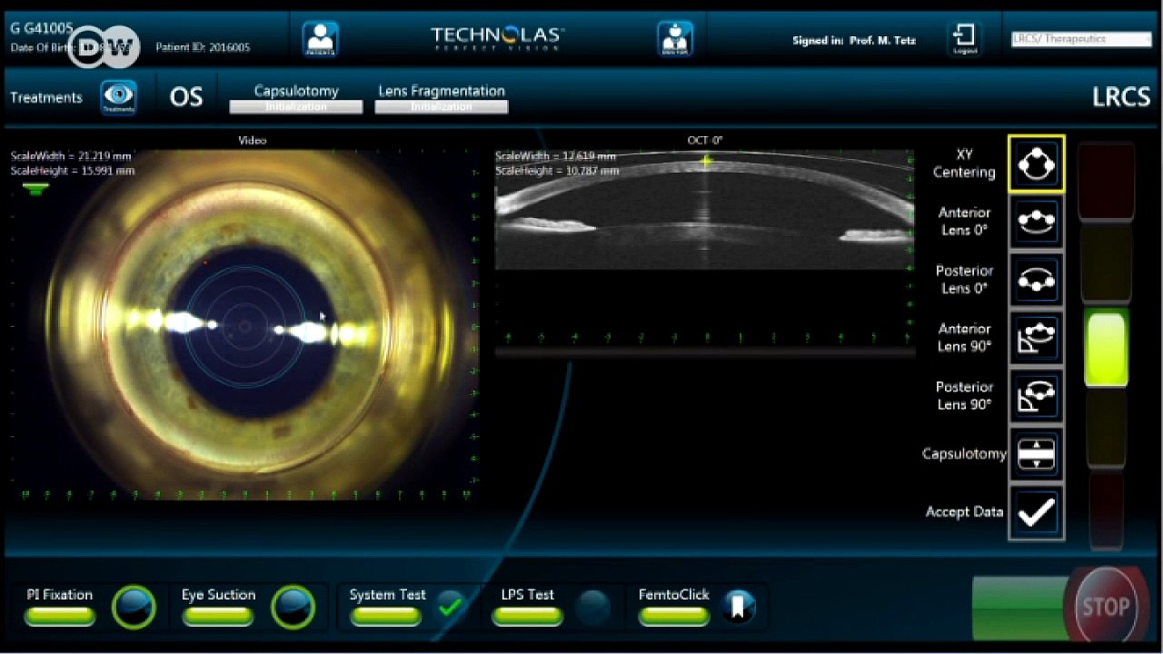 Klare Sicht dank Laser-OP | Fit & gesund