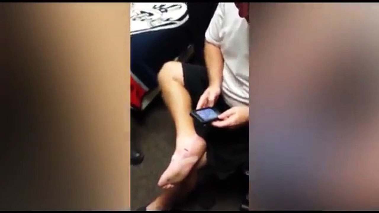 Teammates pull out a MASSIVE splinter from their buddy's foot