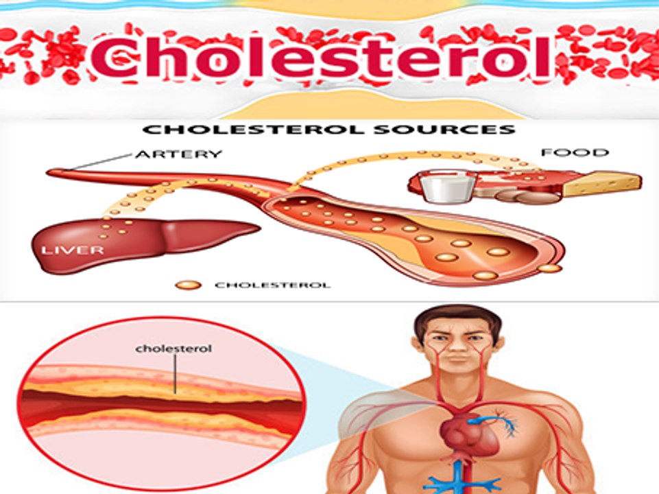 What is cholesterol_ (LDL, HDL) How to prevent and treat bad cholesterol