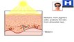 How Does the Sun Affect Your Skin Benefits & Harmful Effects of Sunlight Exposure Animation Video
