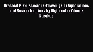 [Read book] Brachial Plexus Lesions: Drawings of Explorations and Reconstructions by Algimantas
