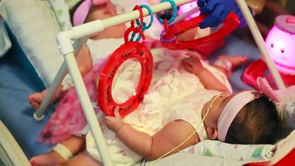 La maman accouche de triplés, 2 d'entre elles ont quelques chose de très particulier