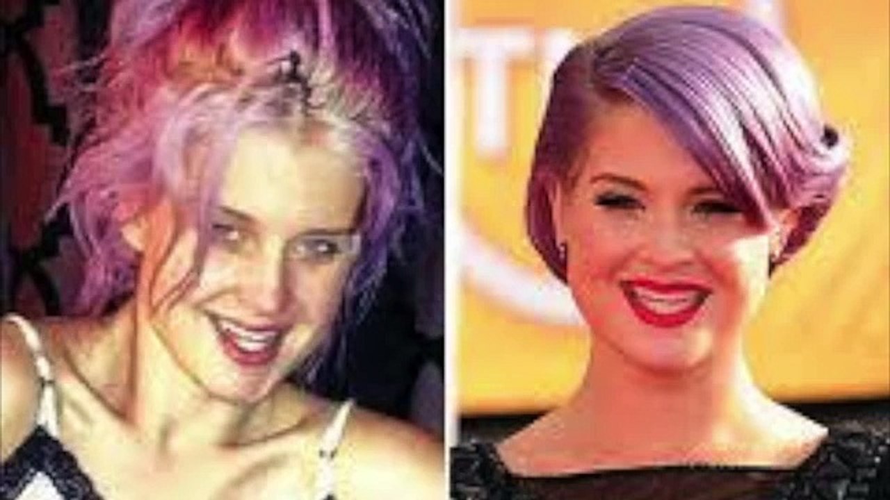 Famous Celebs With No Makeup