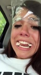 Girl Thinks She's a Vampire after Wisdom Tooth Removal