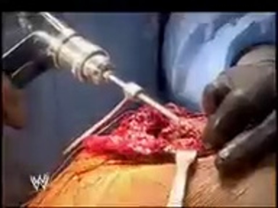 WWE Batista in Emergency Room.mp4