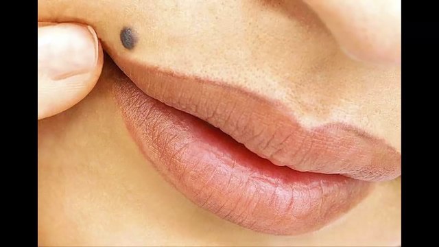 Si usted tiene un lunar en uno de esto 7 lugares en su cuerpo esto es lo que significa. Usted se sor