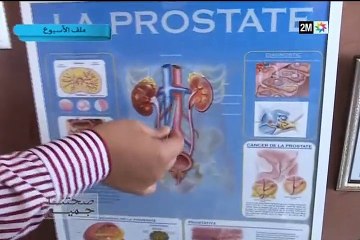 صحتنا جميع: الأحد 24 أبريل