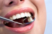 Teath and Gums Healthy tips|how to keep Teeth and Gums Healthy|Health topics