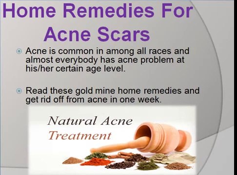 How to get rid of acne scars on face, nose, back, arms, legs fast overnight
