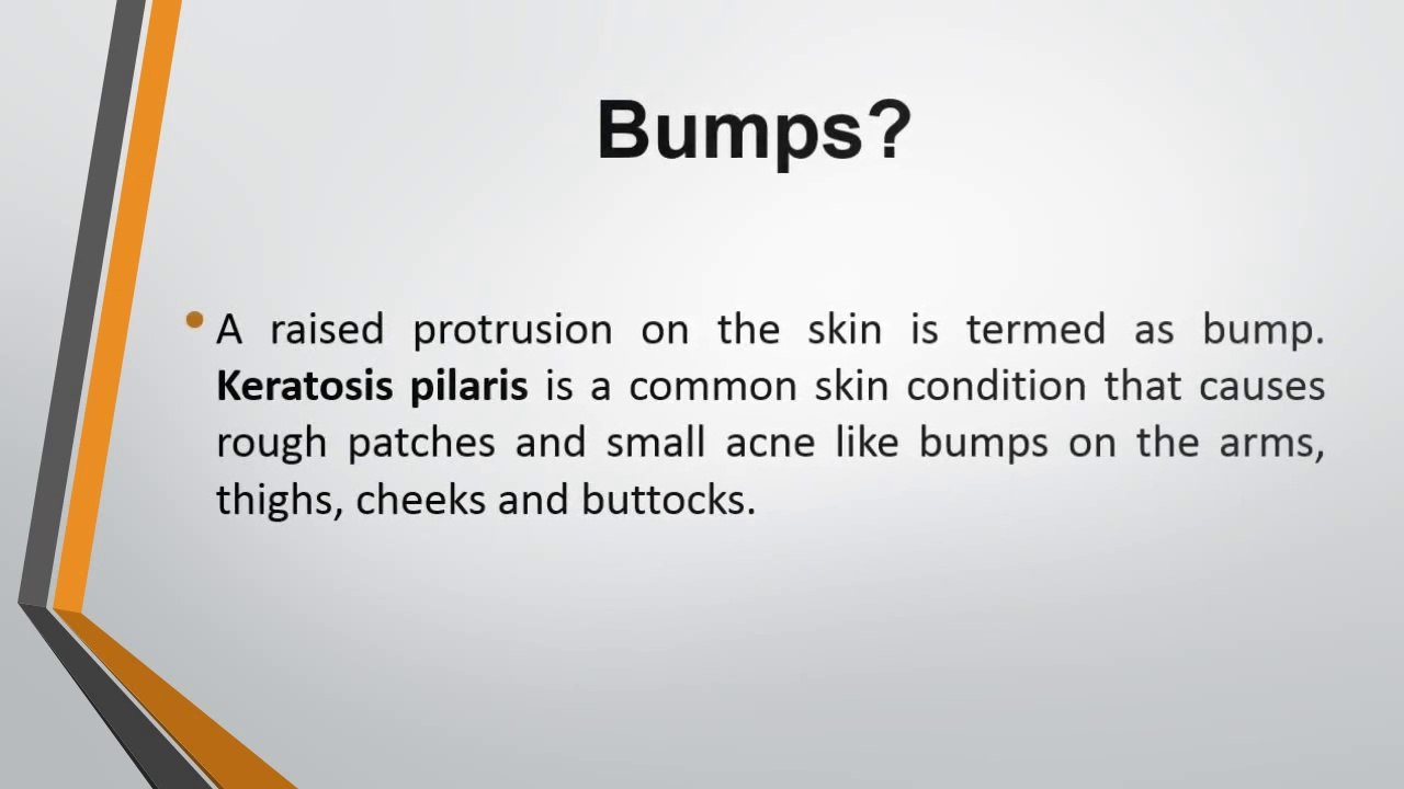 How to get rid of shaving or razor bumps on face, head, neck, legs, bikini, ingrown hair