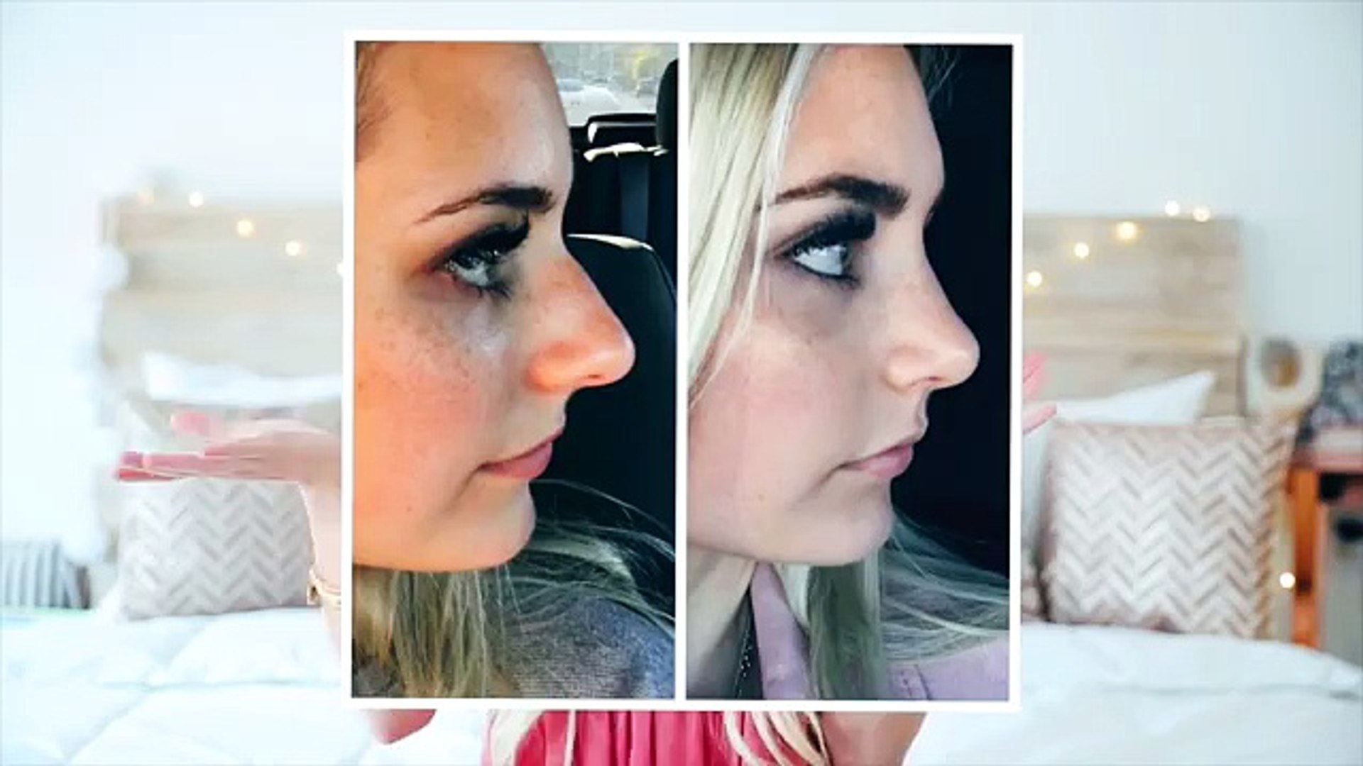 ⁣My Plastic Surgery Experience! _ Aspyn Ovard