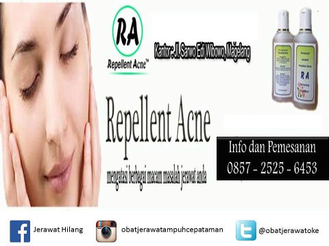 SMS 0857-2525-6453 // Obat paling ampuh menghilangkan jerawat dan bekasnya