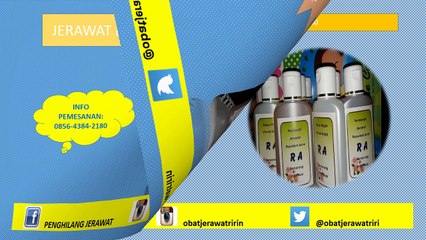 0856-4384-2180 obat jerawat wajah