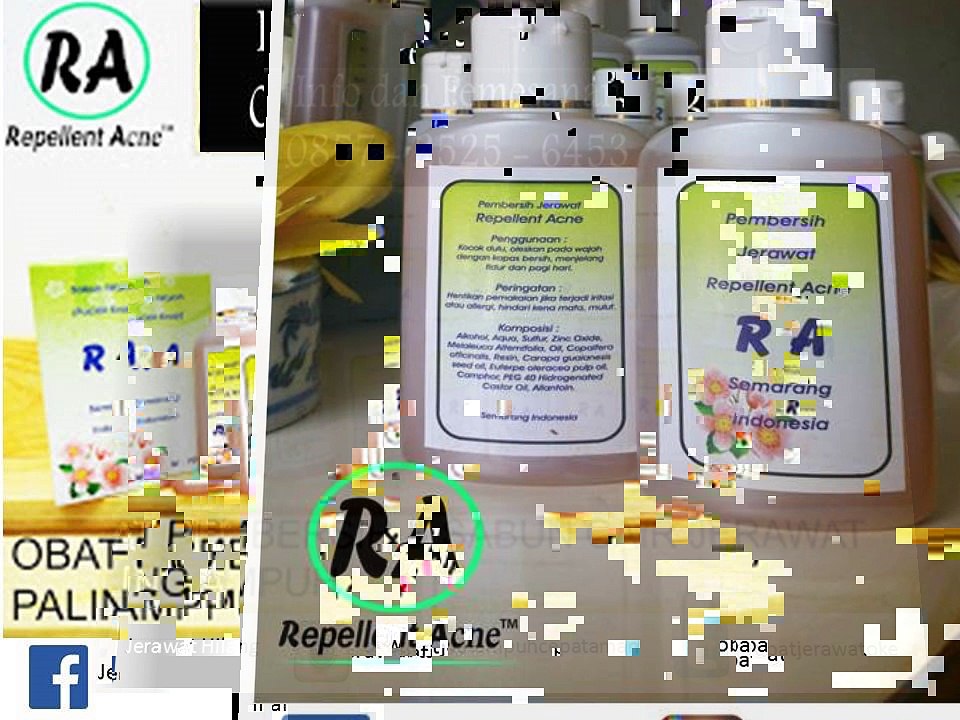 SMS 0857-2525-6453 // Obat ampuh jerawat yang ada di apotik