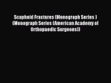 [Read book] Scaphoid Fractures (Monograph Series ) (Monograph Series (American Academy of Orthopaedic