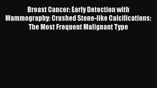 [Read Book] Breast Cancer: Early Detection with Mammography: Crushed Stone-like Calcifications: