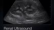2- Kidney & Urinary Bladder Ultrasound