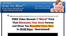 How to naturally get rid of acne scars - acne no more book (Discount)