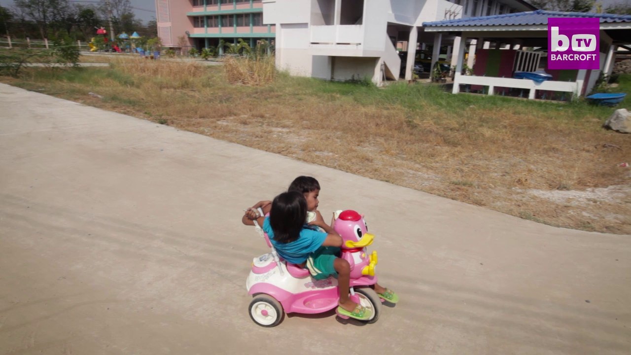 Together Forever: Conjoined Twins Don’t Want To Be Separated