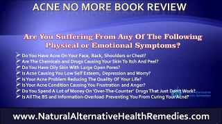 Acne No More Book Review Reveals How To Treat and Cure Acne