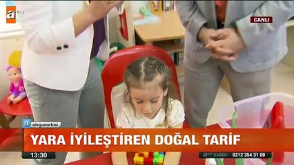 Yara iyileştiren doğal tarif - atv Gün Ortası