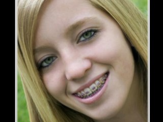 Affordable Orthodontist-Smiles by Dr. W & Dr.R