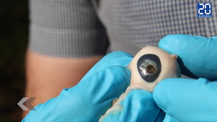 Il brûle une pupille avec un télescope ! - Le rewind du mercredi 27 avril 2016