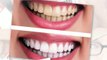 Best cosmetic dentist with teeth whitening cosmetic dentistry in Gilbert AZ
