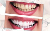Best cosmetic dentist with teeth whitening cosmetic dentistry in Paradise Valley AZ