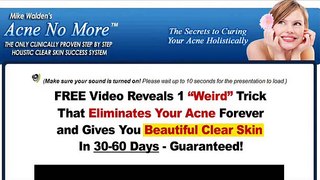 How to naturally get rid of acne scars - acne no more book (Discount)