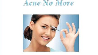 Cure your Acne with Acne no More
