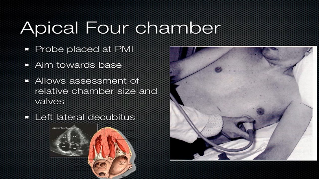 10- Cardiac ultrasound session II