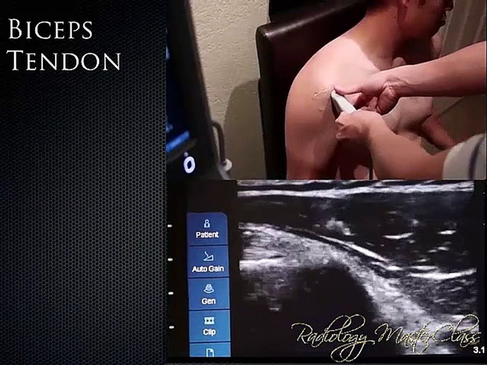 12- Musculoskeletal Anatomical Ultrasound of Shoulder, Knee and Hand